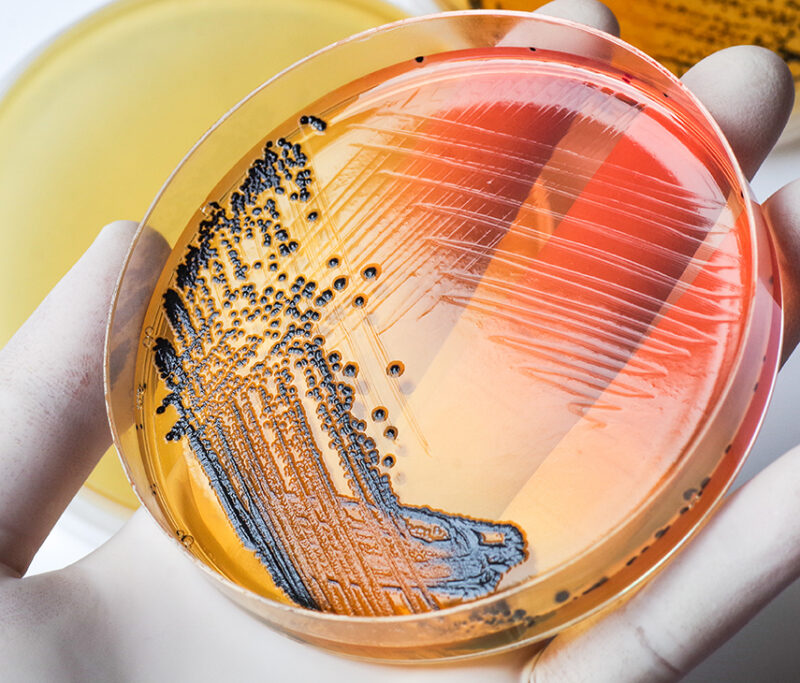 Détecter et dénombrer en méthode alternative - alliance bio expertise