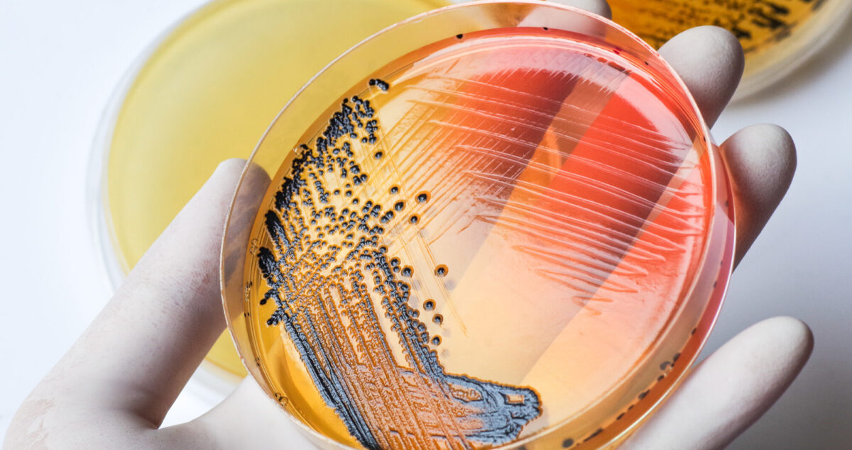 microbiologie agroalimenatire