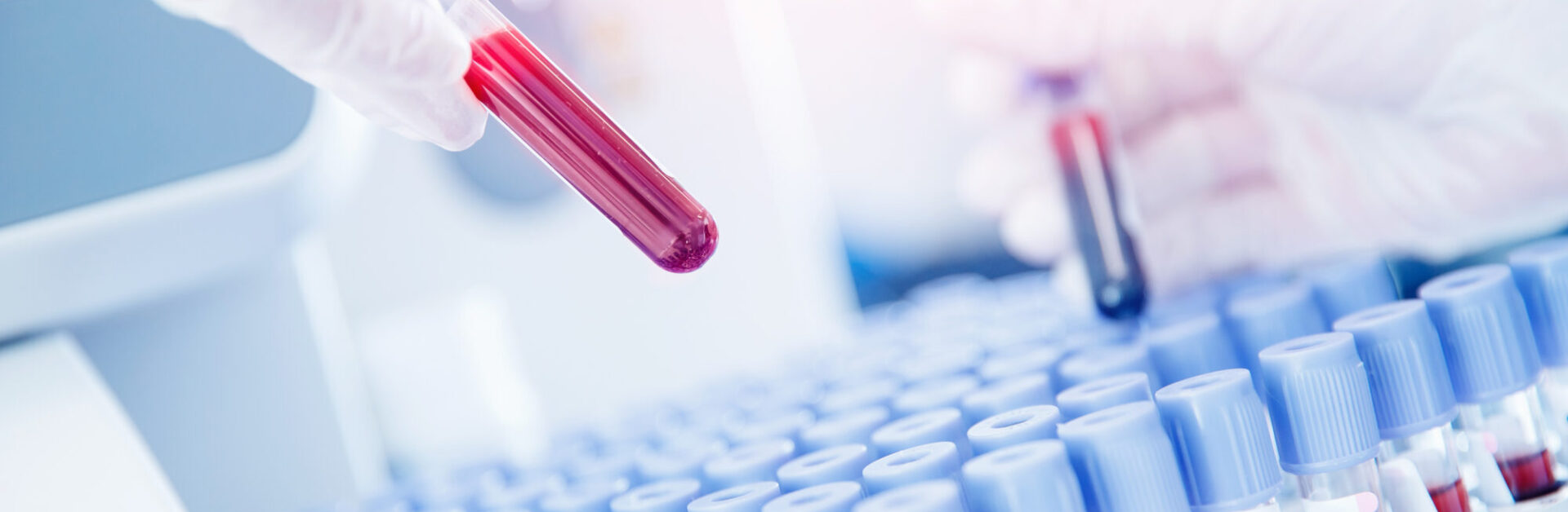 biologie-clinique-alliance-bio-expertise