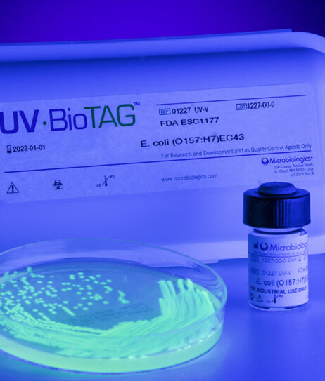 temoignage souches UV